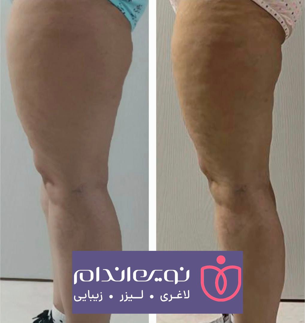 مجموعه زیبایی و لاغری نوین